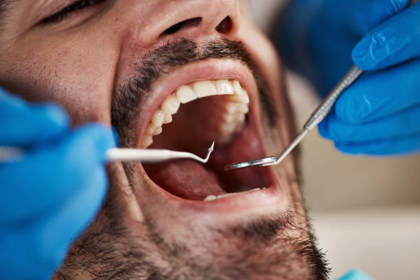 Best Emergency Dental Care for Sports Injuries in Douglass Hills, KY