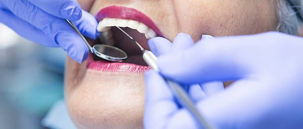 Best Emergency Wisdom Tooth Extraction in Douglass Hills, KY